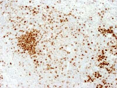 Immunohistochemistry-Paraffin: Ki67/MKI67 Antibody - BSA Free [NB110-89717]