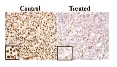 Immunohistochemistry-Paraffin: Ki67/MKI67 Antibody - BSA Free [NB110-89717]
