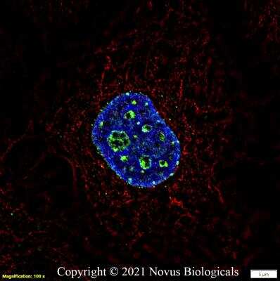 Immunocytochemistry/ Immunofluorescence: Ki67/MKI67 Antibody (1297A) - Azide and BSA Free [NBP2-80822]