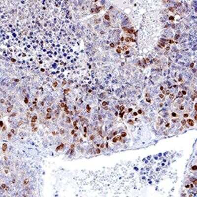 Immunohistochemistry: Ki67/MKI67 Antibody (1297A) - Azide and BSA Free [NBP2-80822]