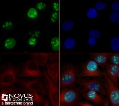 Immunocytochemistry/ Immunofluorescence: Ki67/MKI67 Antibody (1297A) - BSA Free [NBP2-54791]