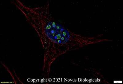 Immunocytochemistry/ Immunofluorescence: Ki67/MKI67 Antibody (1297A) - BSA Free [NBP2-54791]