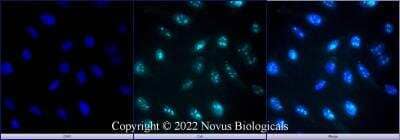 Immunocytochemistry/ Immunofluorescence: Ki67/MKI67 Antibody (1297A) - BSA Free [NBP2-54791]