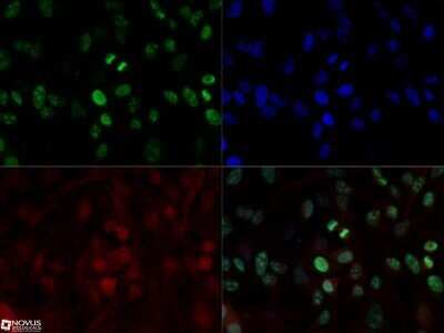 Immunocytochemistry/ Immunofluorescence: Ki67/MKI67 Antibody (8D5) - Azide and BSA Free [NBP2-80821]