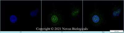 Immunocytochemistry/ Immunofluorescence: Ki67/MKI67 Antibody (8D5) - BSA Free [NBP2-22112]