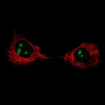 Immunocytochemistry/ Immunofluorescence: Ki67/MKI67 Antibody (CL1234) [NBP2-76476]