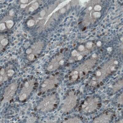 Immunohistochemistry-Paraffin: Ki67/MKI67 Antibody (CL1234) [NBP2-76476]