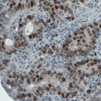 Immunohistochemistry-Paraffin: Ki67/MKI67 Antibody (CL1234) [NBP2-76476]