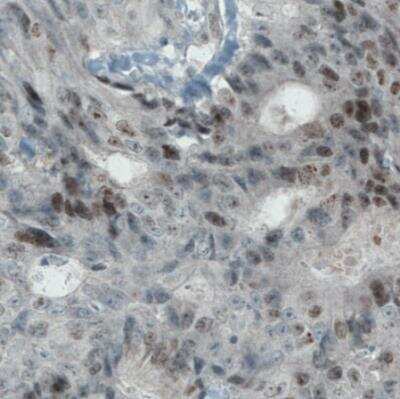 Immunohistochemistry-Paraffin: Ki67/MKI67 Antibody (CL1234) [NBP2-76476]