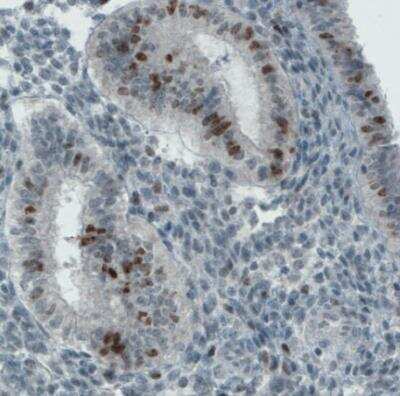 Immunohistochemistry-Paraffin: Ki67/MKI67 Antibody (CL1234) [NBP2-76476]