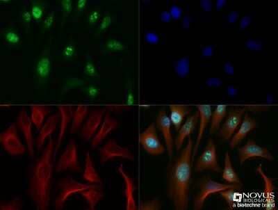 Immunocytochemistry/ Immunofluorescence: Ki67/MKI67 Antibody - BSA Free [NB110-90592]