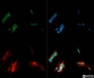 Immunocytochemistry/ Immunofluorescence: Ki67/MKI67 Antibody - BSA Free [NB110-89719]