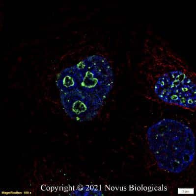 Immunocytochemistry/ Immunofluorescence: Ki67/MKI67 Antibody - BSA Free [NB110-90592]