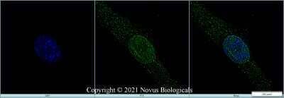 Immunocytochemistry/ Immunofluorescence: Ki67/MKI67 Antibody - BSA Free [NB110-90592]