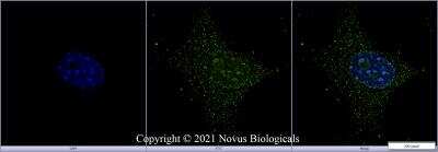 Immunocytochemistry/ Immunofluorescence: Ki67/MKI67 Antibody - BSA Free [NB500-170]