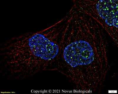 Immunocytochemistry/ Immunofluorescence: Ki67/MKI67 Antibody [NBP2-19012]