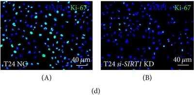 Knockdown Validated: Ki67/MKI67 Antibody [NBP2-19012]