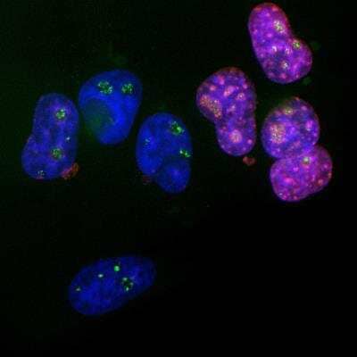 Immunocytochemistry/ Immunofluorescence: Ki67/MKI67 Antibody [NBP3-05537]