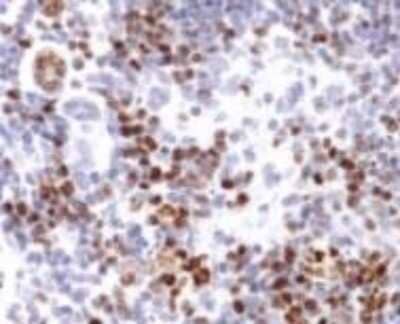 Immunohistochemistry: Ki67/MKI67 Antibody - BSA Free [NB110-89719]