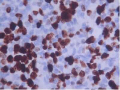 Immunohistochemistry: Ki67/MKI67 Antibody - BSA Free [NB110-90592]