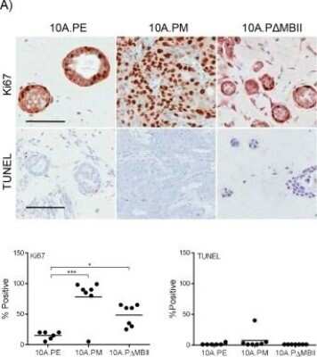 Immunohistochemistry: Ki67/MKI67 Antibody - BSA Free [NB110-90592]
