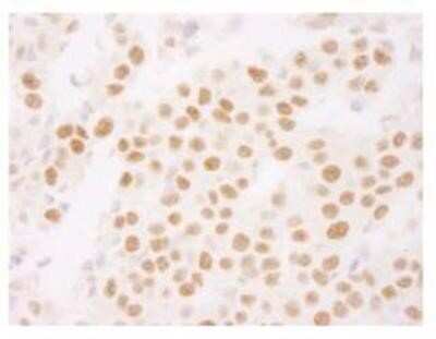 Immunohistochemistry-Paraffin: Ki67/MKI67 Antibody - BSA Free [NB110-89719]