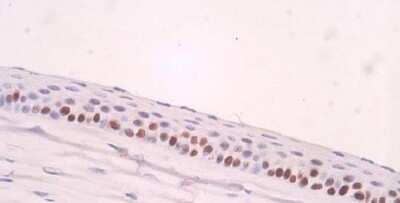 Immunohistochemistry-Paraffin: Ki67/MKI67 Antibody - BSA Free [NB110-89719]