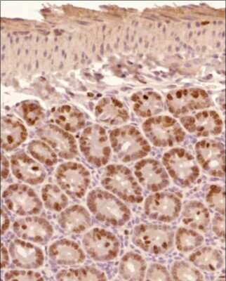 Immunohistochemistry-Paraffin: Ki67/MKI67 Antibody - BSA Free [NB110-89719]