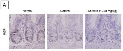 Immunohistochemistry-Paraffin: Ki67/MKI67 Antibody - BSA Free [NB110-89719]