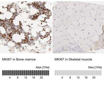 Immunohistochemistry-Paraffin: Ki67/MKI67 Antibody [NBP2-54656]