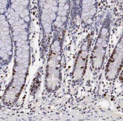 Immunohistochemistry-Paraffin: Ki67/MKI67 Antibody [NBP2-54656]