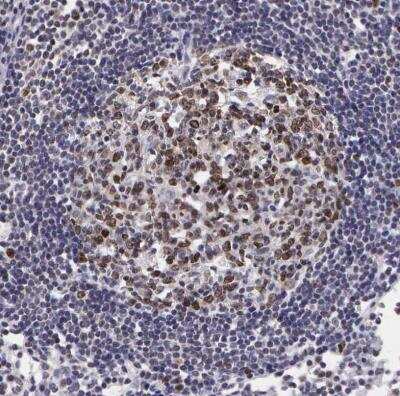 Immunohistochemistry-Paraffin: Ki67/MKI67 Antibody [NBP2-54656]