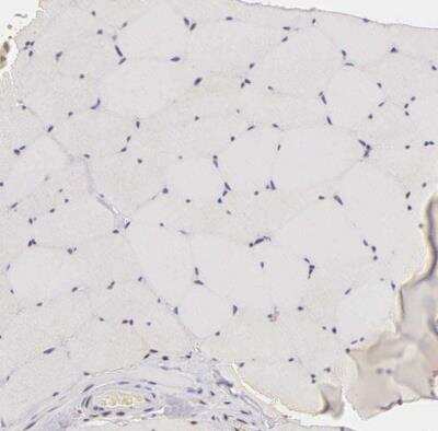 Immunohistochemistry-Paraffin: Ki67/MKI67 Antibody [NBP2-54656]