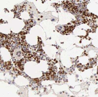 Immunohistochemistry-Paraffin: Ki67/MKI67 Antibody [NBP2-54656]