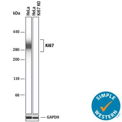 Knockout Validated: Ki67/MKI67 Antibody [NBP2-19012]