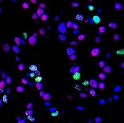 Immunohistochemistry: Ki67/MKI67 Antibody (SP6) - Unpurified [NB600-1252]
