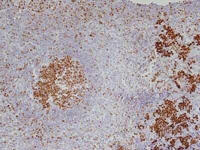 Immunohistochemistry: Ki67/MKI67 Antibody (SP6) - Unpurified [NB600-1252]