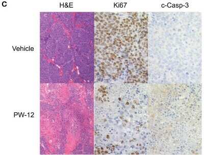 Immunohistochemistry: Ki67/MKI67 Antibody (SP6) - Unpurified [NB600-1252]