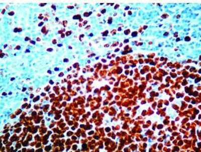 Immunohistochemistry-Paraffin: Ki67/MKI67 Antibody (SP6) - Unpurified [NB600-1252]