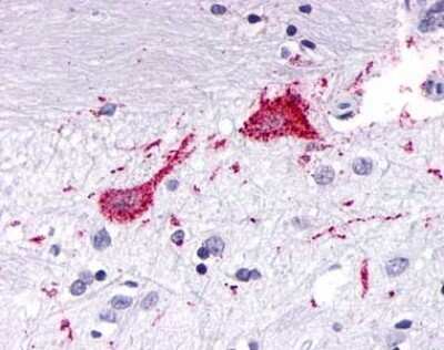 Immunohistochemistry-Paraffin: KiSS1R/GPR54 Antibody - BSA Free [NLS1927]