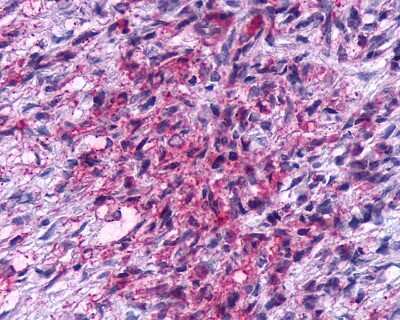 Immunohistochemistry-Paraffin: KiSS1R/GPR54 Antibody - BSA Free [NLS1927]