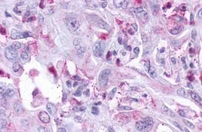 Immunohistochemistry-Paraffin: KiSS1R/GPR54 Antibody - BSA Free [NLS1927]