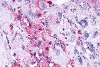 Immunohistochemistry-Paraffin: KiSS1R/GPR54 Antibody - BSA Free [NLS1927]