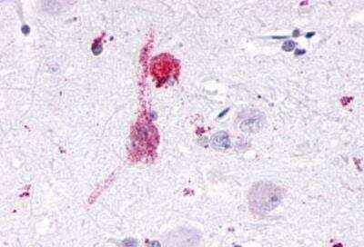 Immunohistochemistry-Paraffin: KiSS1R/GPR54 Antibody - BSA Free [NLS1927]