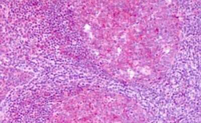 Immunohistochemistry-Paraffin: KiSS1R/GPR54 Antibody - BSA Free [NLS1928]