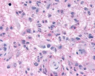 Immunohistochemistry-Paraffin: KiSS1R/GPR54 Antibody - BSA Free [NLS1929]