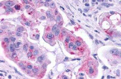 Immunohistochemistry-Paraffin: KiSS1R/GPR54 Antibody - BSA Free [NLS1929]
