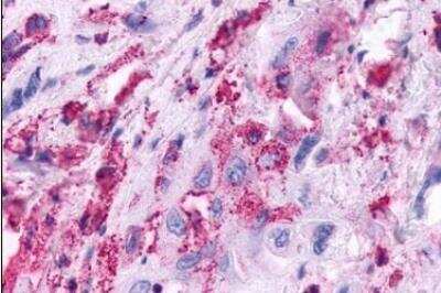 Immunohistochemistry-Paraffin: KiSS1R/GPR54 Antibody - BSA Free [NLS1929]