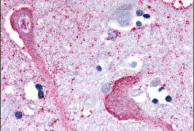 Immunohistochemistry-Paraffin: KiSS1R/GPR54 Antibody - BSA Free [NLS1929]