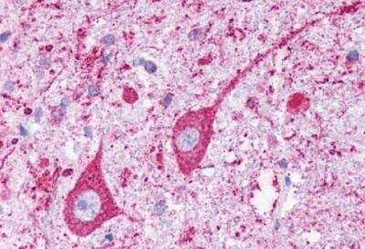 Immunohistochemistry-Paraffin: KiSS1R/GPR54 Antibody - BSA Free [NLS1929]